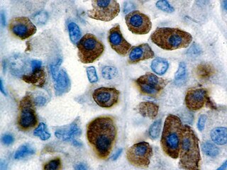 IHC of Growth Hormone on a FFPE Pituitary Tissue
